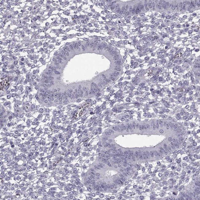 PRPH2 Antibody in Immunohistochemistry (Paraffin) (IHC (P))