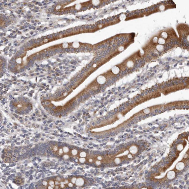 C7orf43 Antibody in Immunohistochemistry (Paraffin) (IHC (P))