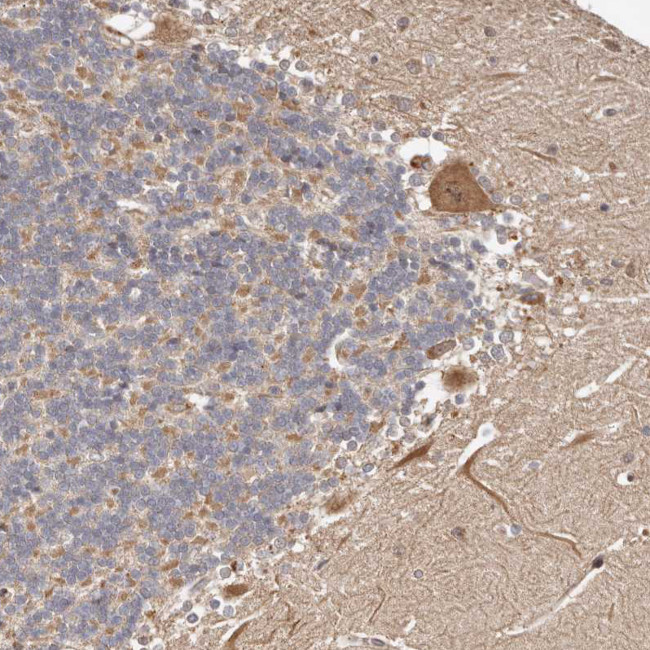 LCHN Antibody in Immunohistochemistry (Paraffin) (IHC (P))