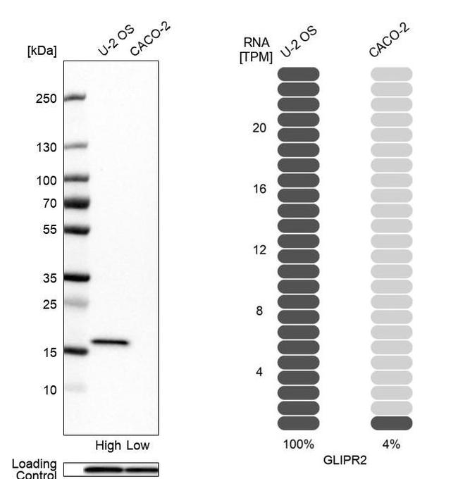 GLIPR2 Antibody in Western Blot (WB)
