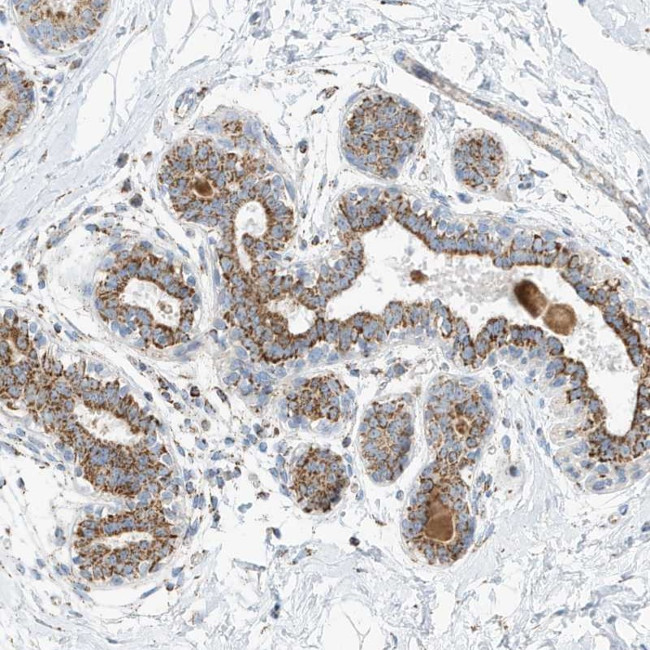 Calpain 13 Antibody in Immunohistochemistry (Paraffin) (IHC (P))