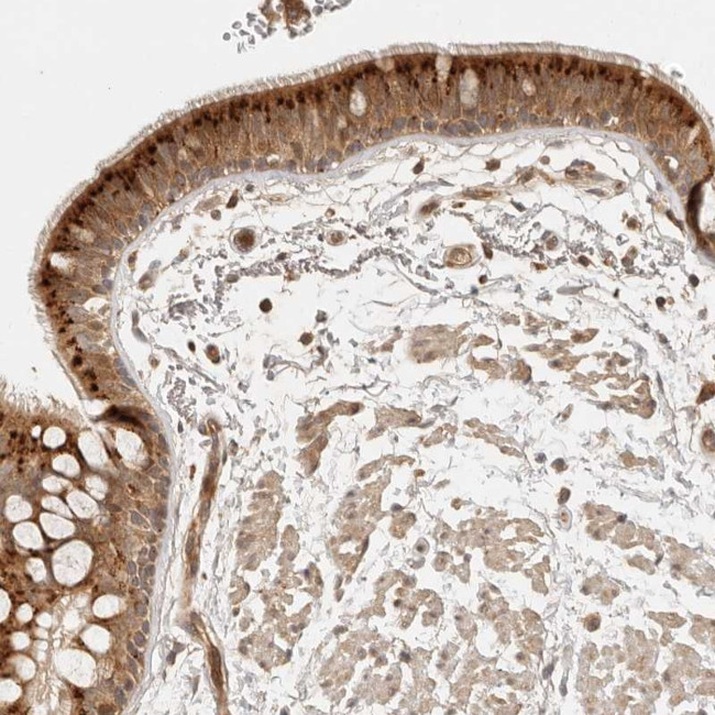 ANKRD61 Antibody in Immunohistochemistry (Paraffin) (IHC (P))