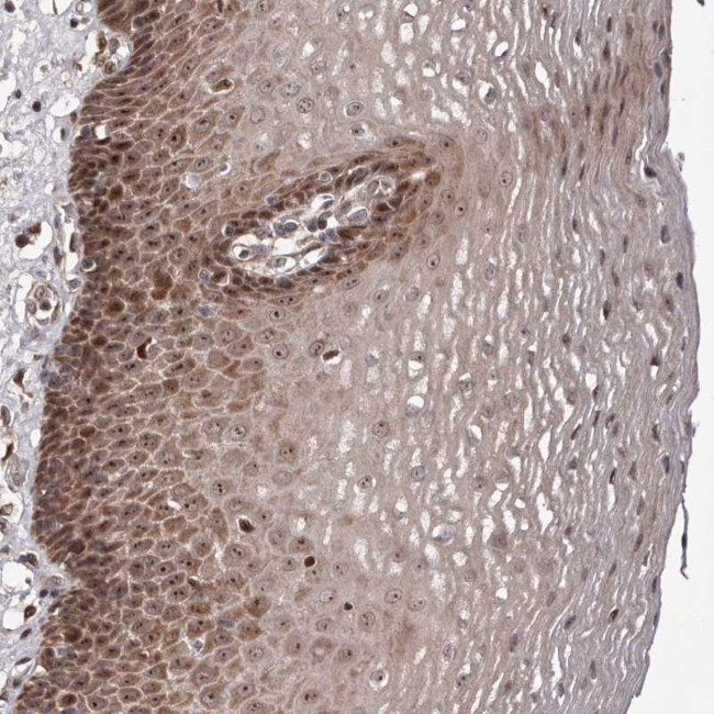 ZCCHC7 Antibody in Immunohistochemistry (Paraffin) (IHC (P))