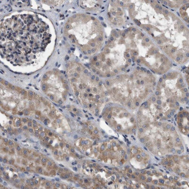 NRBP Antibody in Immunohistochemistry (IHC)