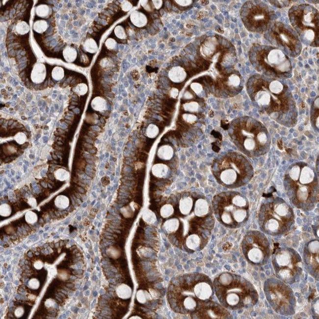 ZNF114 Antibody in Immunohistochemistry (Paraffin) (IHC (P))