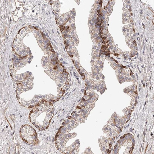 ZNF502 Antibody in Immunohistochemistry (IHC)