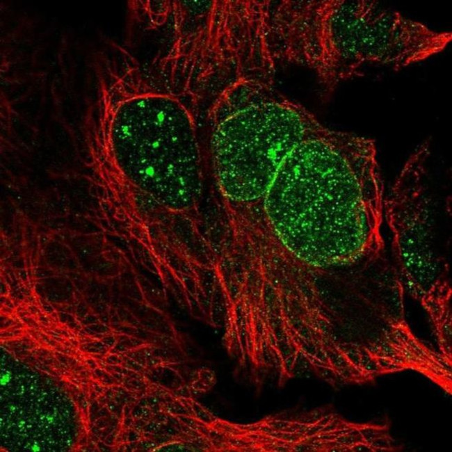 RANBP17 Antibody in Immunocytochemistry (ICC/IF)
