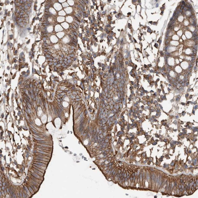 DENND6B Antibody in Immunohistochemistry (Paraffin) (IHC (P))