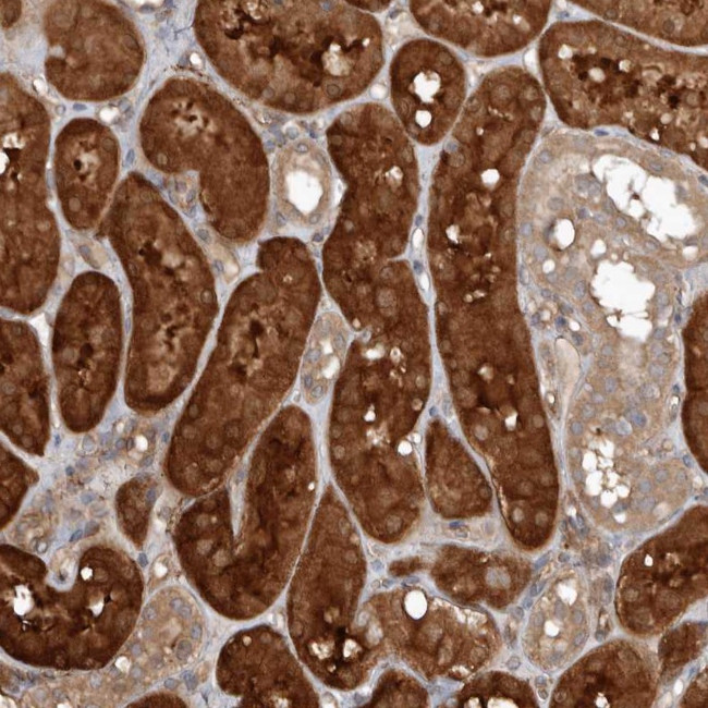EXOC3L1 Antibody in Immunohistochemistry (Paraffin) (IHC (P))