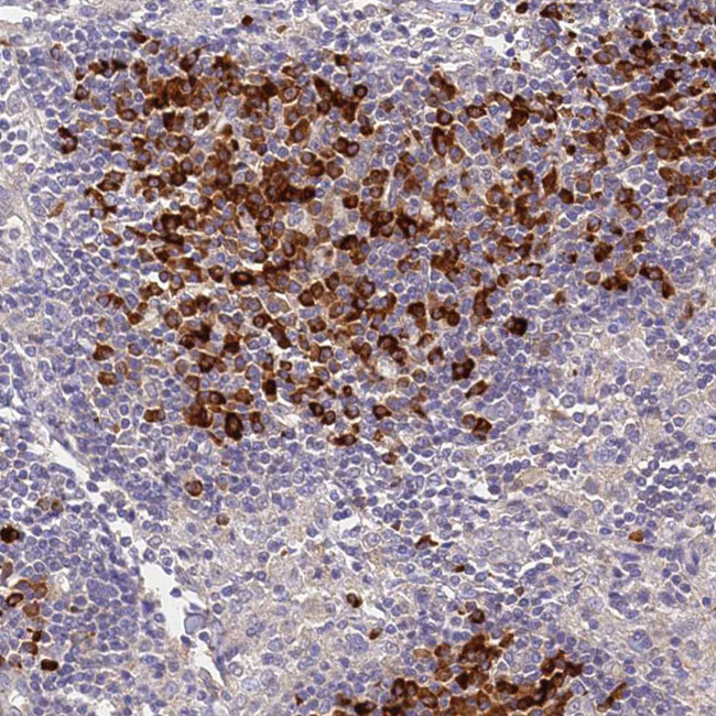SLC11A1 Antibody in Immunohistochemistry (Paraffin) (IHC (P))