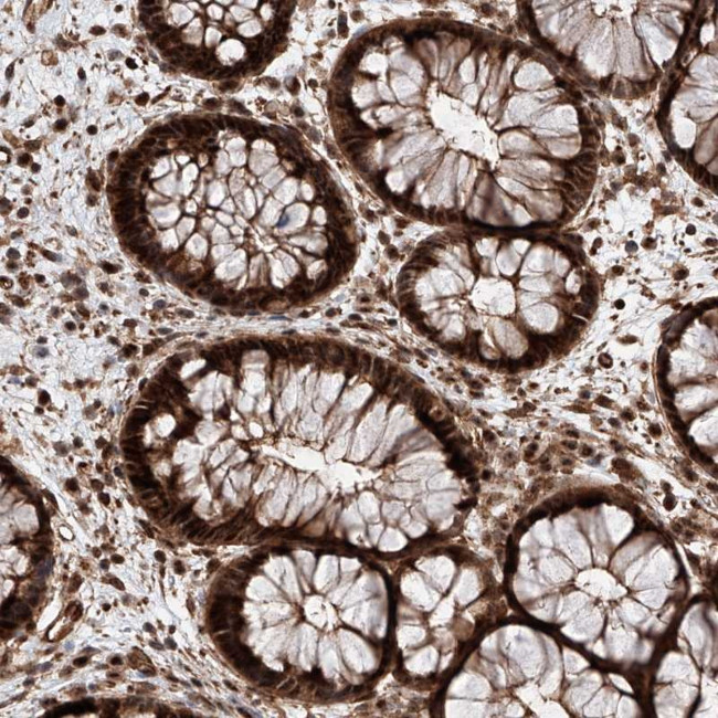AIM1L Antibody in Immunohistochemistry (Paraffin) (IHC (P))