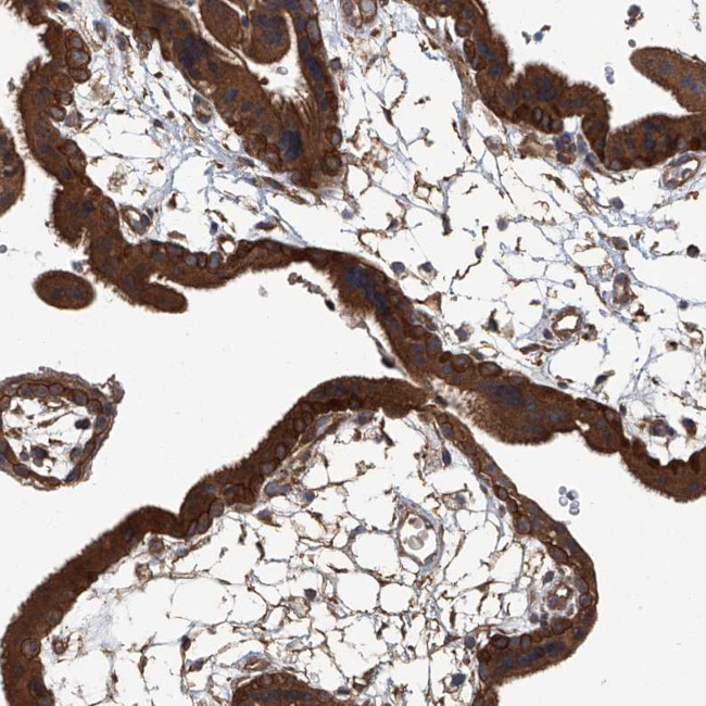 ANKRD34A Antibody in Immunohistochemistry (Paraffin) (IHC (P))