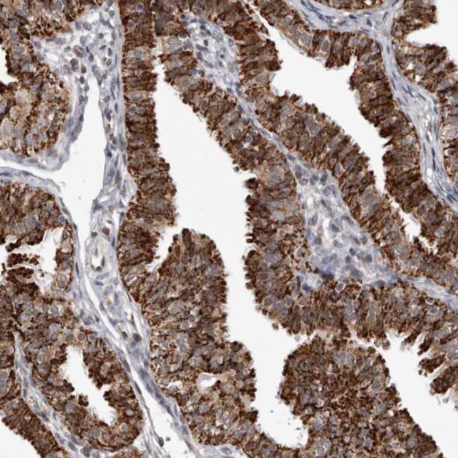 C17orf99 Antibody in Immunohistochemistry (Paraffin) (IHC (P))