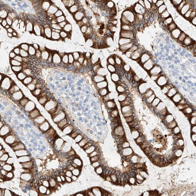 MAP7 Antibody in Immunohistochemistry (Paraffin) (IHC (P))