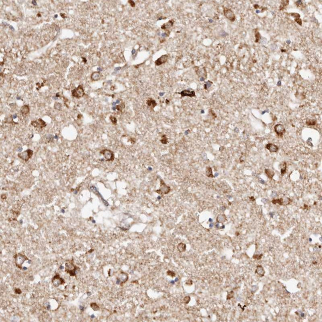 BCL2L15 Antibody in Immunohistochemistry (Paraffin) (IHC (P))