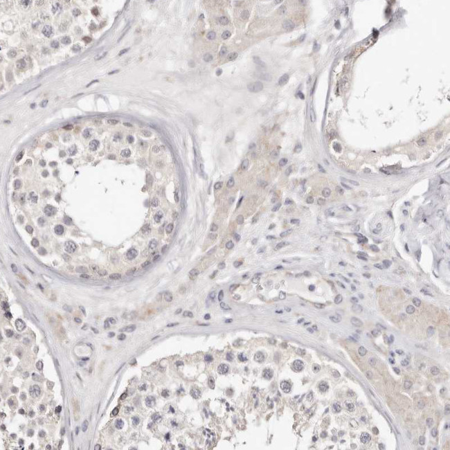 BCL2L15 Antibody in Immunohistochemistry (Paraffin) (IHC (P))