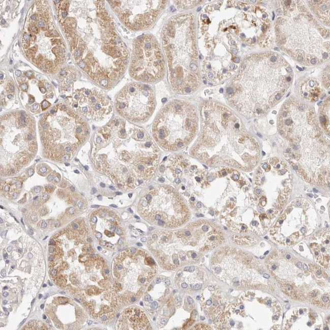 MYOM3 Antibody in Immunohistochemistry (Paraffin) (IHC (P))