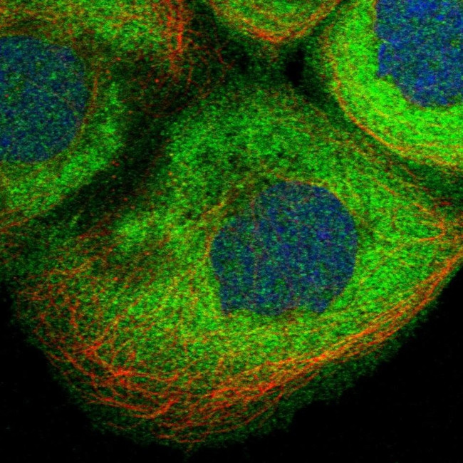 CDV3 Antibody in Immunocytochemistry (ICC/IF)