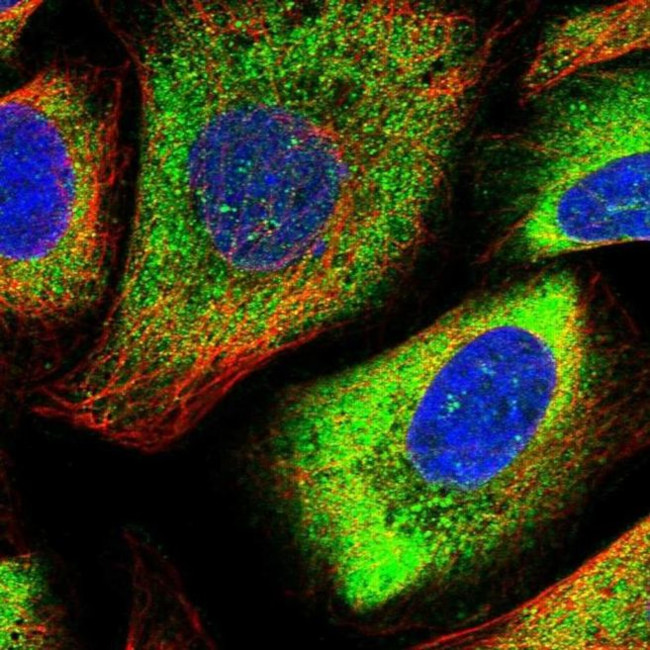 CDV3 Antibody in Immunocytochemistry (ICC/IF)