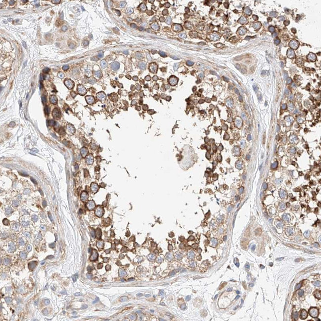 C6orf118 Antibody in Immunohistochemistry (Paraffin) (IHC (P))