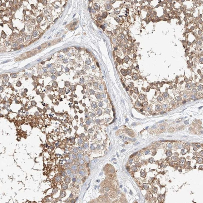 C6orf118 Antibody in Immunohistochemistry (IHC)