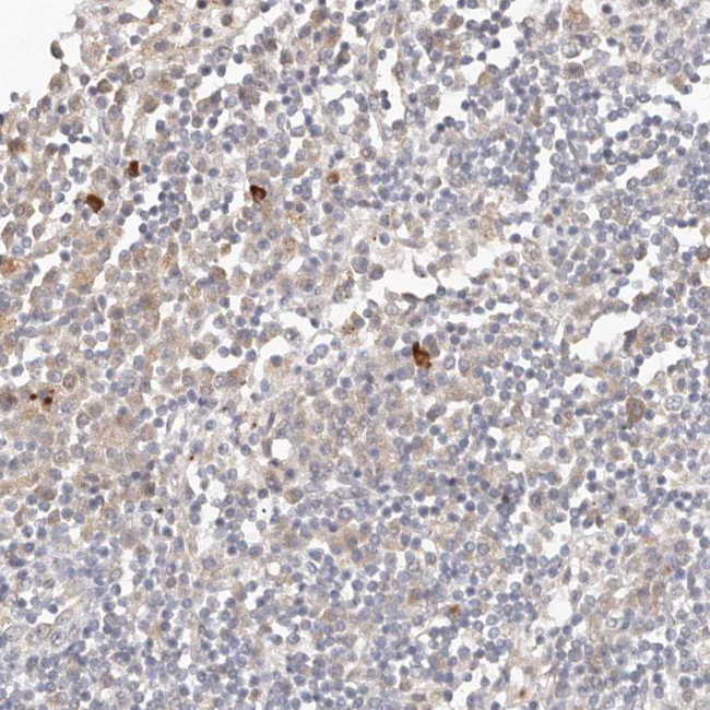 FAM54A Antibody in Immunohistochemistry (IHC)