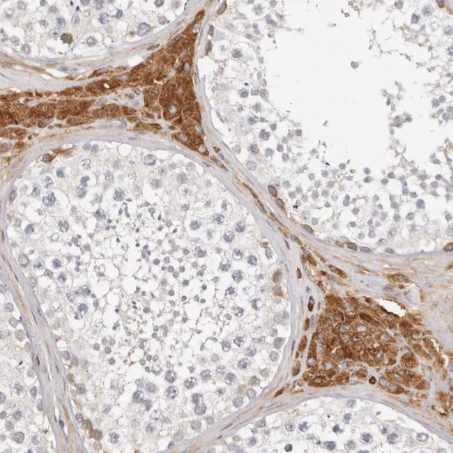 FAM54A Antibody in Immunohistochemistry (Paraffin) (IHC (P))