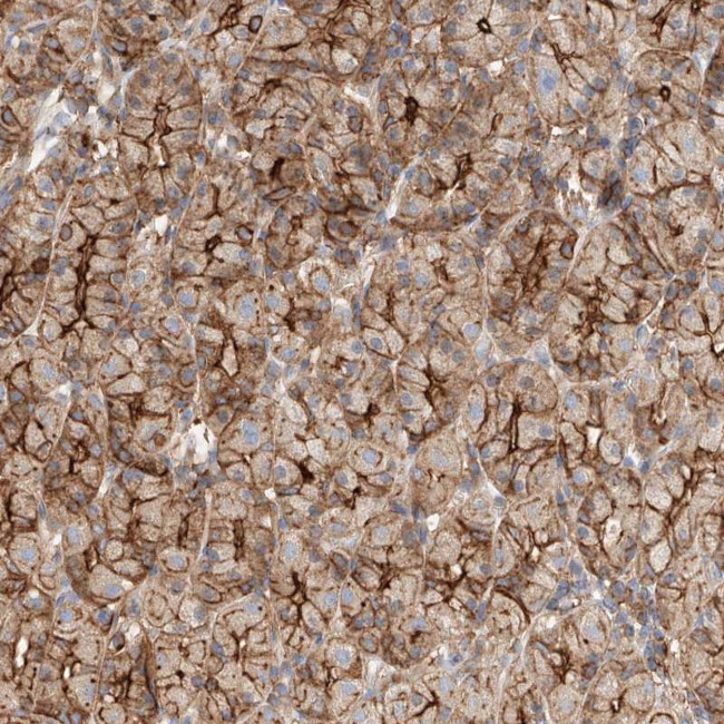HAUS4 Antibody in Immunohistochemistry (Paraffin) (IHC (P))