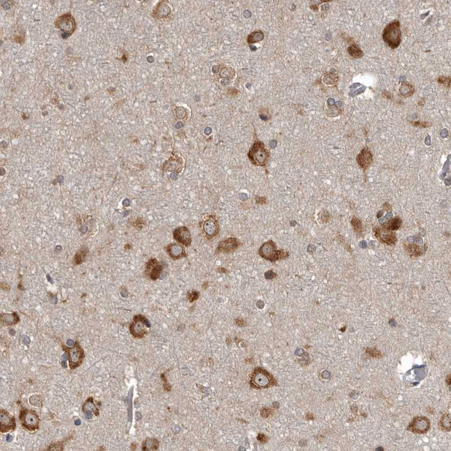 DARS Antibody in Immunohistochemistry (Paraffin) (IHC (P))
