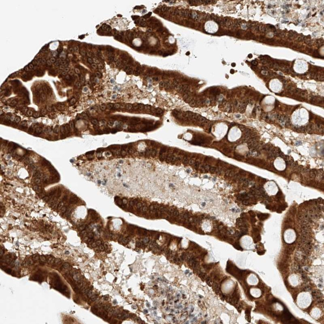 ATXN7L2 Antibody in Immunohistochemistry (Paraffin) (IHC (P))