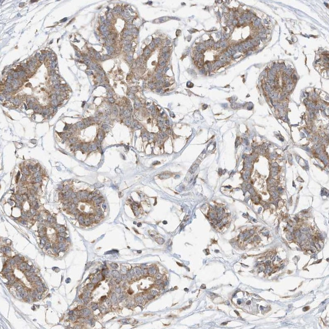 CAGE1 Antibody in Immunohistochemistry (Paraffin) (IHC (P))