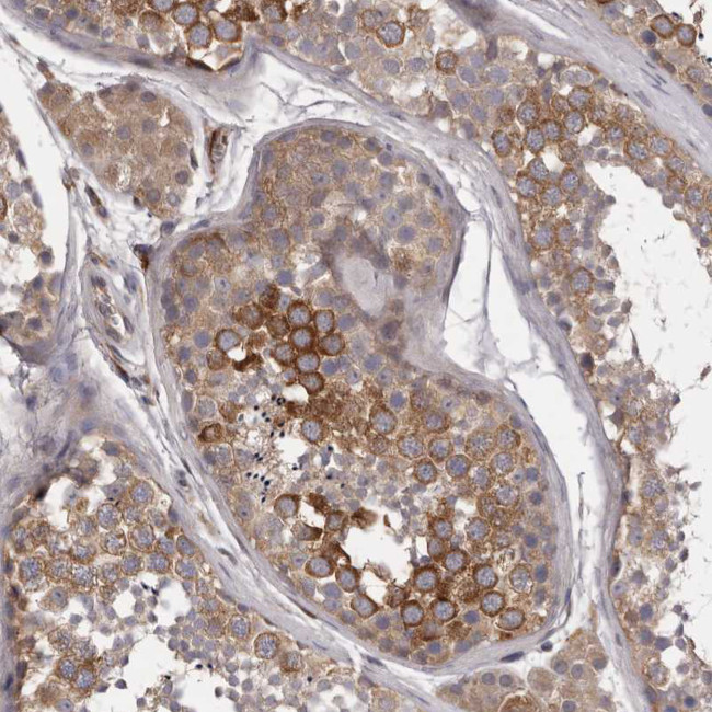 PNRC1 Antibody in Immunohistochemistry (IHC)