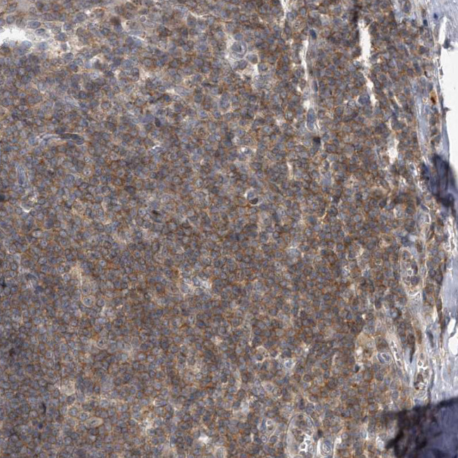 PGBD2 Antibody in Immunohistochemistry (Paraffin) (IHC (P))