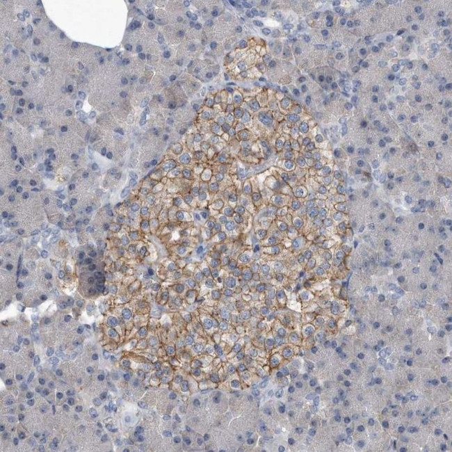 PGBD2 Antibody in Immunohistochemistry (IHC)
