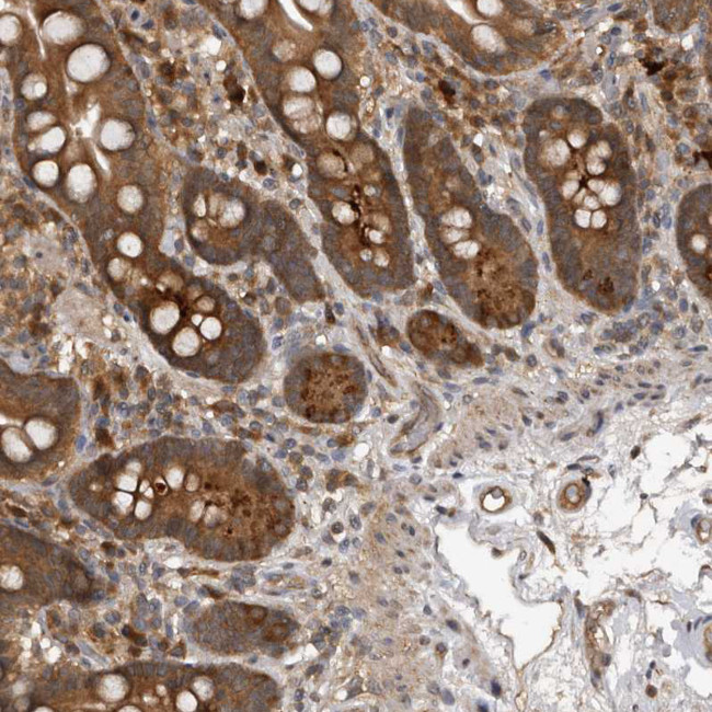 PMVK Antibody in Immunohistochemistry (Paraffin) (IHC (P))