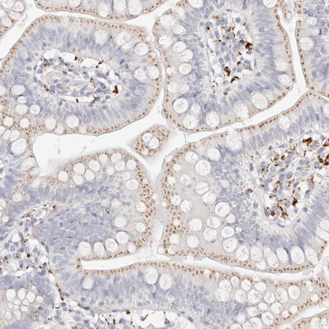 STKLD1 Antibody in Immunohistochemistry (Paraffin) (IHC (P))