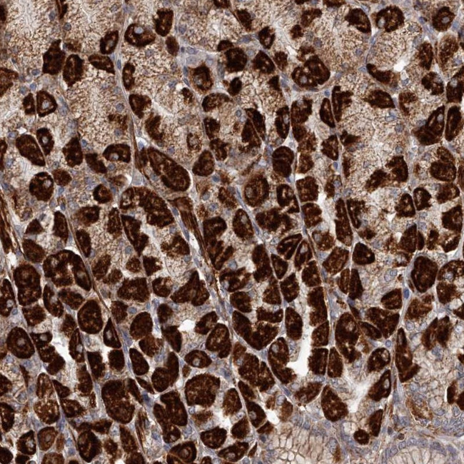 RRP36 Antibody in Immunohistochemistry (Paraffin) (IHC (P))