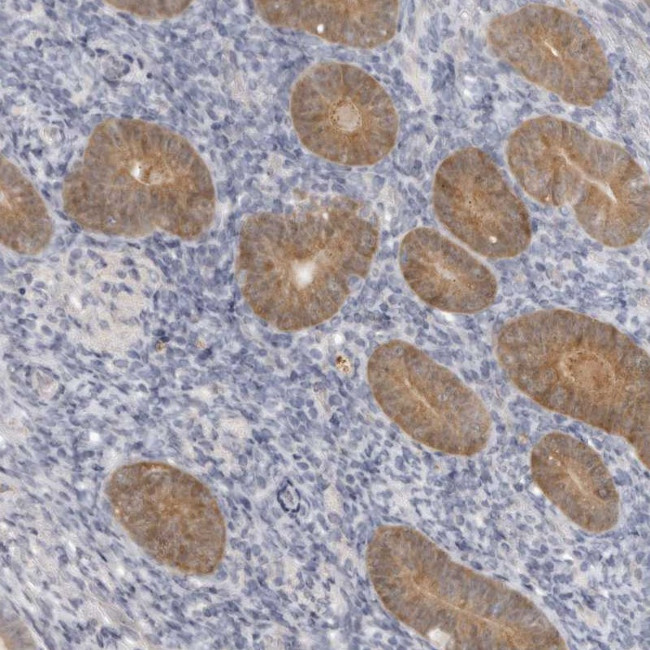 GGCT Antibody in Immunohistochemistry (Paraffin) (IHC (P))