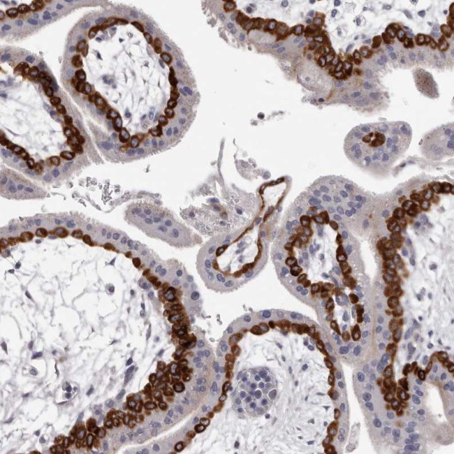PEG10 Antibody in Immunohistochemistry (Paraffin) (IHC (P))