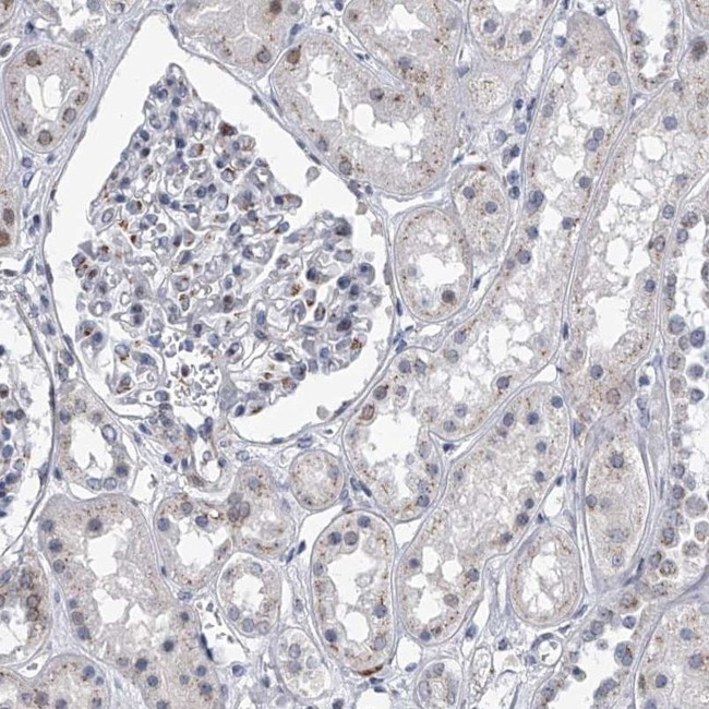 C21orf63 Antibody in Immunohistochemistry (IHC)
