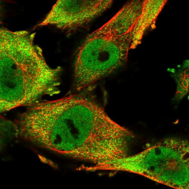 SASH1 Antibody in Immunocytochemistry (ICC/IF)