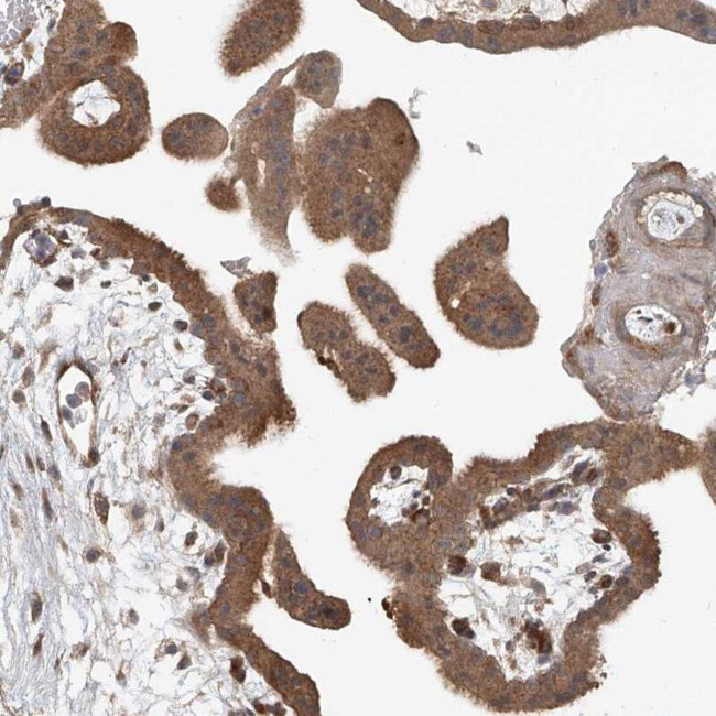 SASH1 Antibody in Immunohistochemistry (IHC)