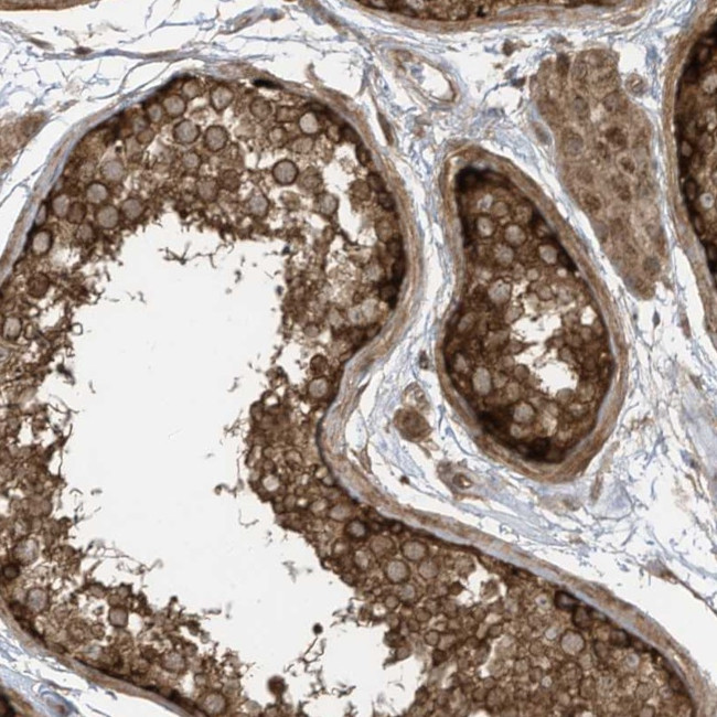 REPS1 Antibody in Immunohistochemistry (Paraffin) (IHC (P))