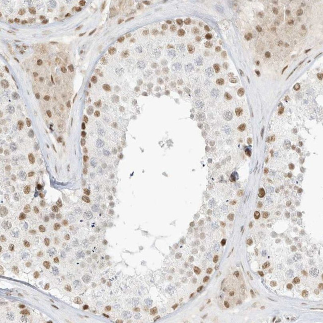 NHSL1 Antibody in Immunohistochemistry (IHC)