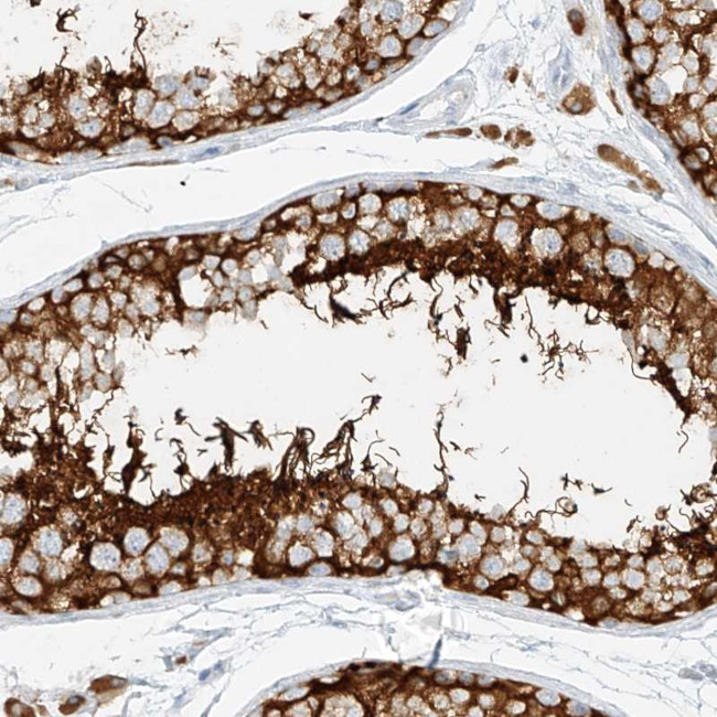 NHSL1 Antibody in Immunohistochemistry (Paraffin) (IHC (P))