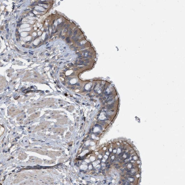 Calpain 13 Antibody in Immunohistochemistry (Paraffin) (IHC (P))
