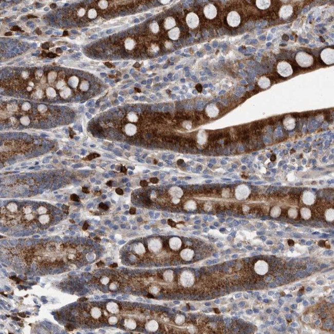 CRISPLD2 Antibody in Immunohistochemistry (Paraffin) (IHC (P))