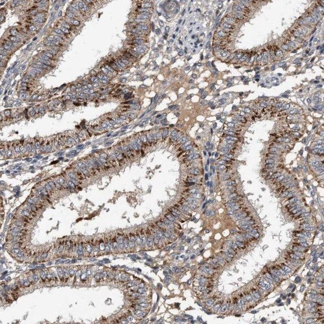 PI15 Antibody in Immunohistochemistry (IHC)