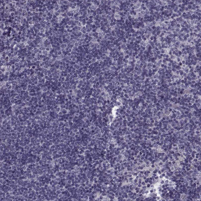 SYNGR4 Antibody in Immunohistochemistry (Paraffin) (IHC (P))