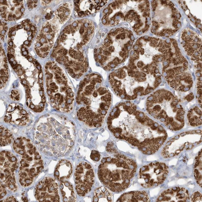 RAB11FIP3 Antibody in Immunohistochemistry (Paraffin) (IHC (P))